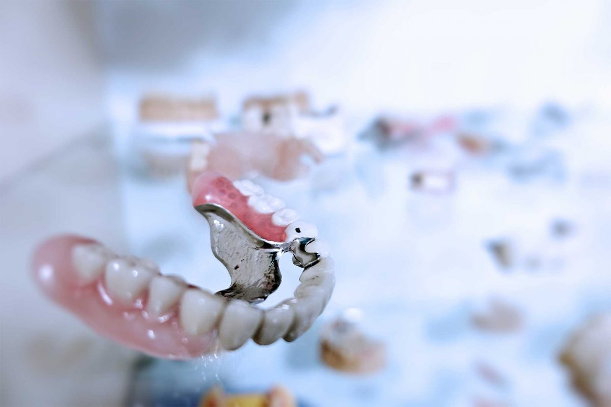 Removable Partial Denture Sinterex 