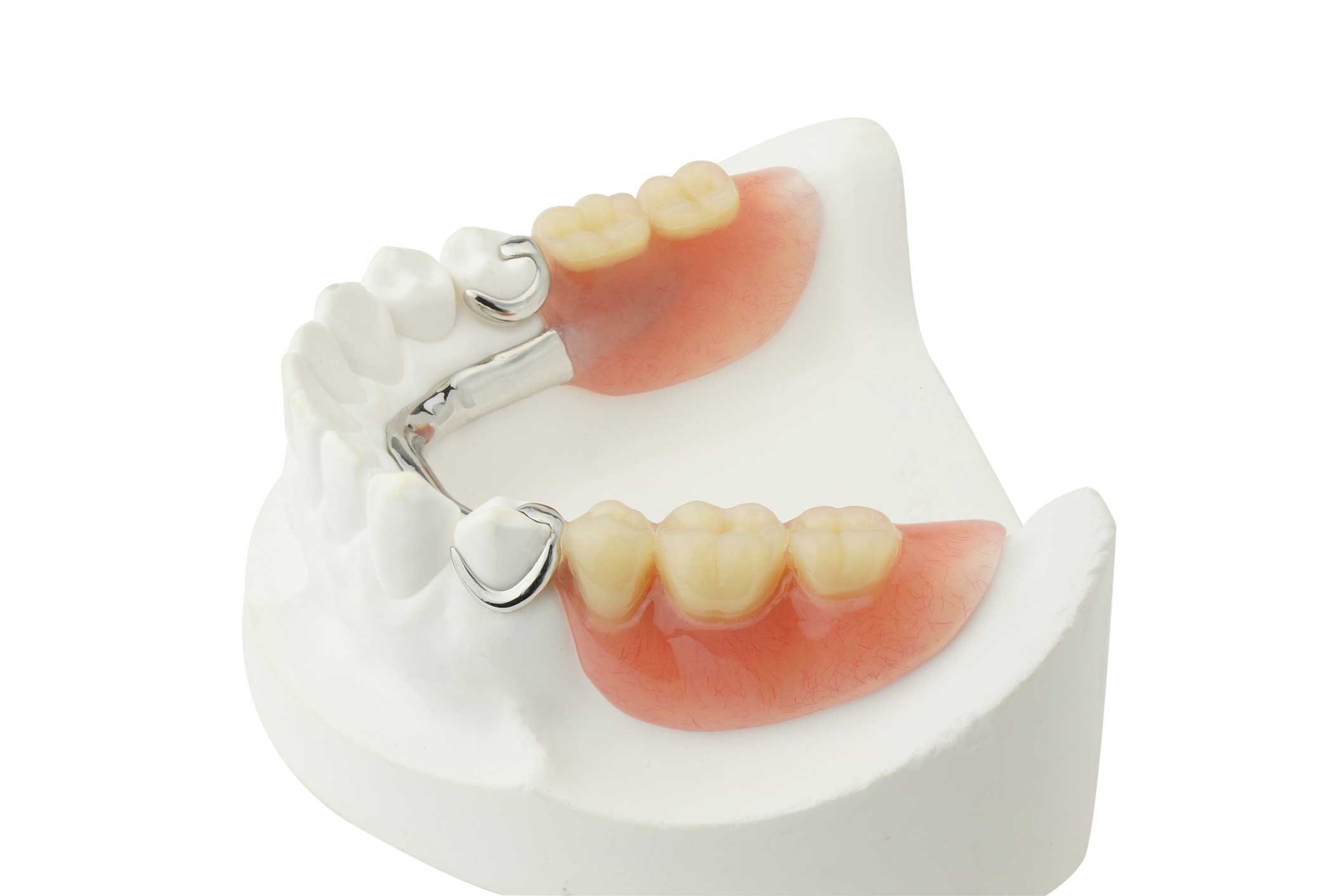 removable-partial-denture-sinterex